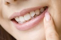 ホワイトニング