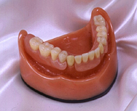 入れ歯（義歯）